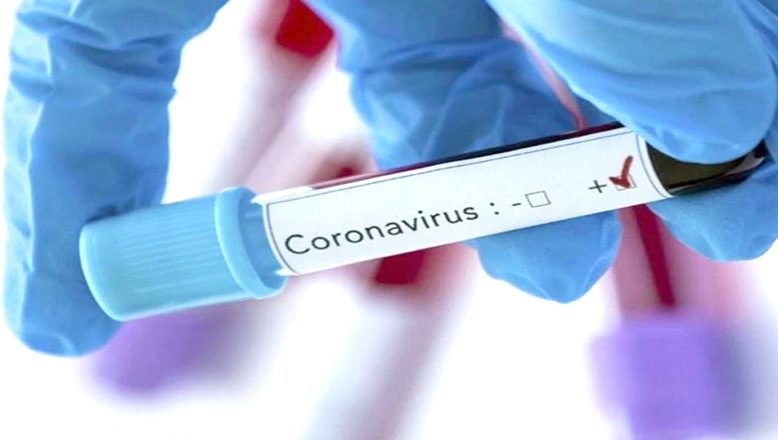 Koronavirüste vaka ve can kaybı artıyor!
