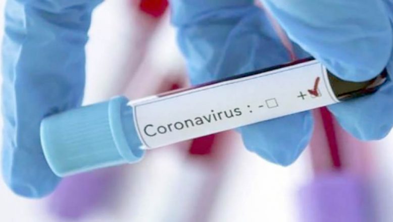 Koronavirüste can kaybı 574’e vaka sayısı ise  27 bin 69’a yükseldi